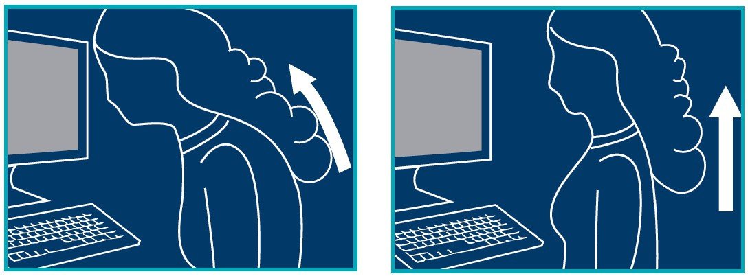 Soutien-Gorge correcteur de Posture avec support de Dos en X Art, 9595 ORIONE®