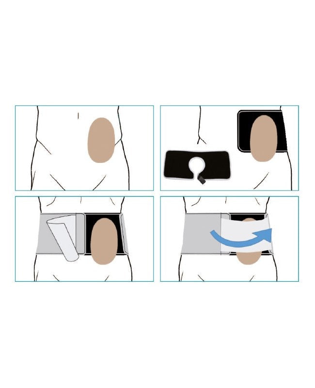 Bande de stomie ORIONE Ref.3052 hauteur 16 cm.